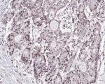 MLH1 Antibody in Immunohistochemistry (Paraffin) (IHC (P))