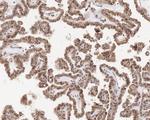 GNAQ Antibody in Immunohistochemistry (Paraffin) (IHC (P))