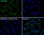 CRALBP Antibody in Immunocytochemistry (ICC/IF)