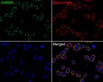 CARD9 Antibody in Immunocytochemistry (ICC/IF)