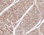 Arp2 Antibody in Immunohistochemistry (Paraffin) (IHC (P))