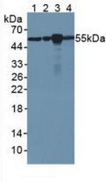 beta Tubulin Antibody in Western Blot (WB)