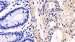 COL1A1 Antibody in Immunohistochemistry (Paraffin) (IHC (P))