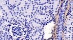 COL1A1 Antibody in Immunohistochemistry (Paraffin) (IHC (P))