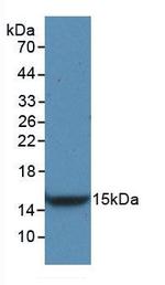 VEGFC Antibody in Western Blot (WB)