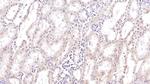 SIRT3 Antibody in Immunohistochemistry (Paraffin) (IHC (P))