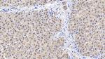 CEACAM1 Antibody in Immunohistochemistry (Paraffin) (IHC (P))