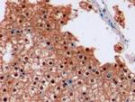 Arginase 1 Antibody in Immunohistochemistry (Paraffin) (IHC (P))