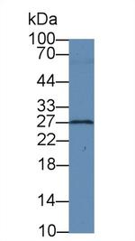 BDNF Antibody in Western Blot (WB)