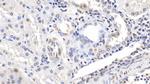 ENO1 Antibody in Immunohistochemistry (Paraffin) (IHC (P))