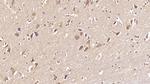 DCLK1 Antibody in Immunohistochemistry (Paraffin) (IHC (P))