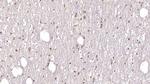 DCLK1 Antibody in Immunohistochemistry (Paraffin) (IHC (P))