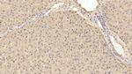 Prothrombin Fragment 1/2 Antibody in Immunohistochemistry (Paraffin) (IHC (P))