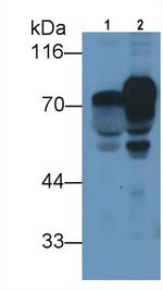 Prothrombin Fragment 1/2 Antibody in Western Blot (WB)