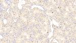 RIP1 Antibody in Immunohistochemistry (Paraffin) (IHC (P))