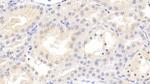 MMP7 Antibody in Immunohistochemistry (Paraffin) (IHC (P))