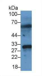 MMP7 Antibody in Western Blot (WB)