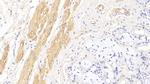 alpha-Cardiac Actin Antibody in Immunohistochemistry (Paraffin) (IHC (P))