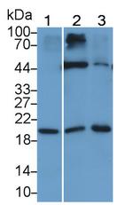 IL-15 Antibody in Western Blot (WB)