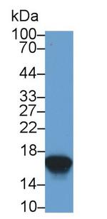 CST1 Antibody in Western Blot (WB)