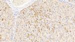 alpha-1 Antitrypsin Antibody in Immunohistochemistry (Paraffin) (IHC (P))