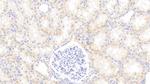 alpha-1 Antitrypsin Antibody in Immunohistochemistry (Paraffin) (IHC (P))