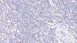 alpha-1 Antitrypsin Antibody in Immunohistochemistry (Paraffin) (IHC (P))