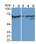 alpha-1 Antitrypsin Antibody in Western Blot (WB)