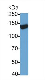 TRPM4 Antibody in Western Blot (WB)