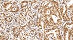 HDAC1 Antibody in Immunohistochemistry (Paraffin) (IHC (P))