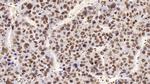 HDAC1 Antibody in Immunohistochemistry (Paraffin) (IHC (P))