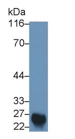 COMT Antibody in Western Blot (WB)