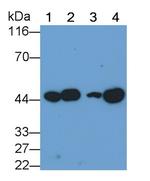 VEGFC Antibody in Western Blot (WB)