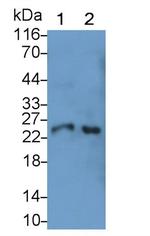 Cathepsin S Antibody in Western Blot (WB)