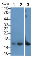 CRABP2 Antibody in Western Blot (WB)