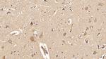 ACVR2A Antibody in Immunohistochemistry (Paraffin) (IHC (P))