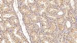 ACVR2A Antibody in Immunohistochemistry (Paraffin) (IHC (P))