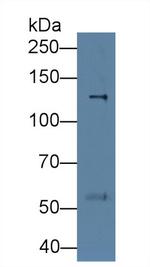 Procollagen I N-Peptide Antibody in Western Blot (WB)