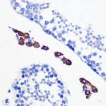 Bax Antibody in Immunohistochemistry (Paraffin) (IHC (P))