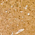 NSE Antibody in Immunohistochemistry (Paraffin) (IHC (P))