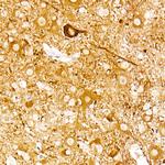 NSE Antibody in Immunohistochemistry (Paraffin) (IHC (P))