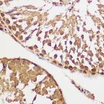 AKT Pan Antibody in Immunohistochemistry (Paraffin) (IHC (P))