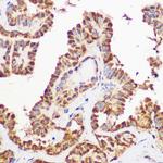 AKT Pan Antibody in Immunohistochemistry (Paraffin) (IHC (P))