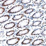 PARP1 Antibody in Immunohistochemistry (Paraffin) (IHC (P))