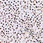 PARP1 Antibody in Immunohistochemistry (Paraffin) (IHC (P))