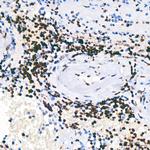 PARP1 Antibody in Immunohistochemistry (Paraffin) (IHC (P))