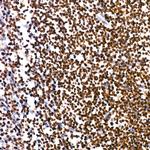 PARP1 Antibody in Immunohistochemistry (Paraffin) (IHC (P))