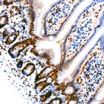 PARP1 Antibody in Immunohistochemistry (Paraffin) (IHC (P))