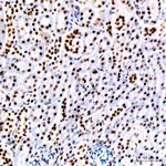 PARP1 Antibody in Immunohistochemistry (Paraffin) (IHC (P))