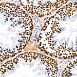 PARP1 Antibody in Immunohistochemistry (Paraffin) (IHC (P))